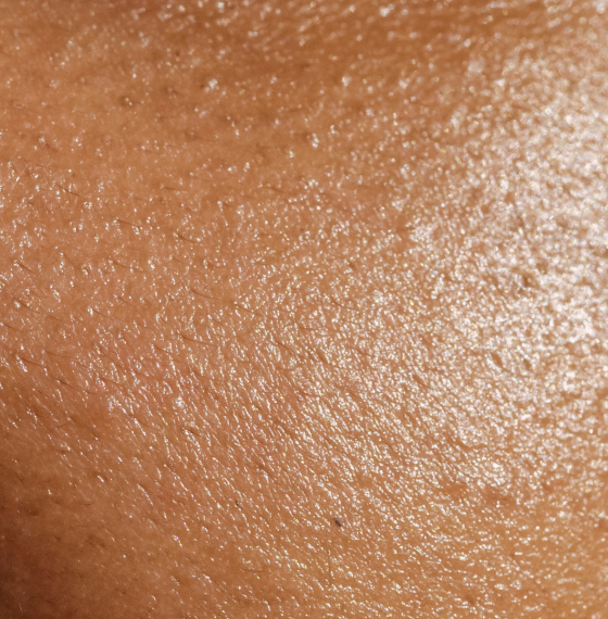 peau-visage